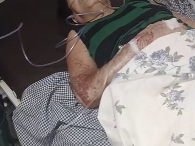 Help my lola with medical expenses ?